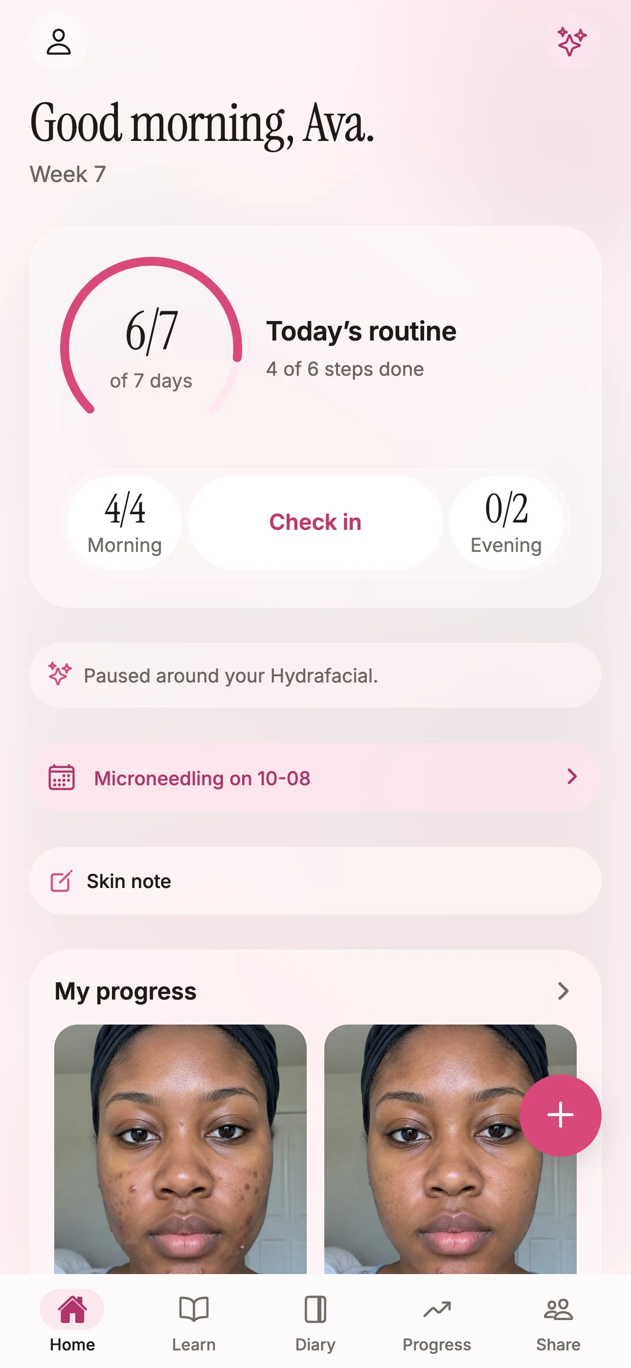 The Glow home screen: today&rsquo;s routine, how much of it is done, and a note about a recent treatment.